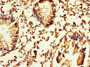 ATP8A1 Antibody - Immunohistochemistry of paraffin-embedded human appendix tissue at dilution of 1:100