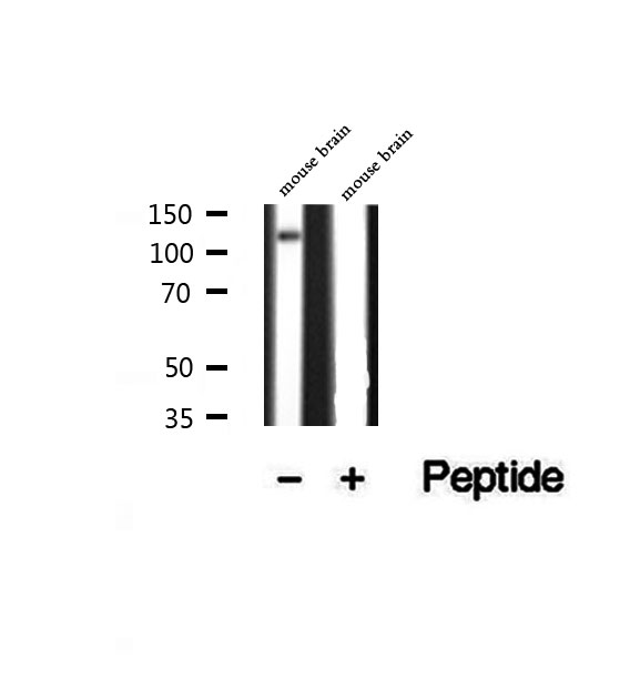 ATP8A1 Antibody - Western blot analysis of extracts of mouse brain tissue using ATP8A1 antibody.