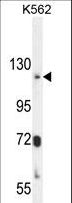 ATP8A2 Antibody - ATP8A2 Antibody western blot of K562 cell line lysates (35 ug/lane). The ATP8A2 antibody detected the ATP8A2 protein (arrow).