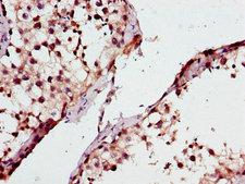 ATP8A2 Antibody - Immunohistochemistry of paraffin-embedded human testis tissue using ATP8A2 Antibody at dilution of 1:100