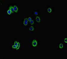 ATP8B1 / BRIC Antibody - Immunofluorescent analysis of HepG2 cells diluted at 1:100 and Alexa Fluor 488-congugated AffiniPure Goat Anti-Rabbit IgG(H+L)