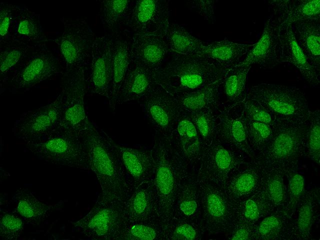 ATP8B4 Antibody - Immunofluorescence staining of ATP8B4 in U2OS cells. Cells were fixed with 4% PFA, permeabilzed with 0.3% Triton X-100 in PBS, blocked with 10% serum, and incubated with rabbit anti-Human ATP8B4 polyclonal antibody (dilution ratio 1:200) at 4°C overnight. Then cells were stained with the Alexa Fluor 488-conjugated Goat Anti-rabbit IgG secondary antibody (green). Positive staining was localized to Nucleus and Cytoplasm.