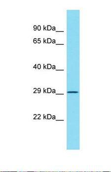 ATPAF2 Antibody - Western blot of Rat Lung. Atpaf2 antibody dilution 1.0 ug/ml.  This image was taken for the unconjugated form of this product. Other forms have not been tested.