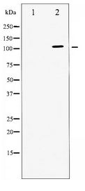 ATPase Antibody - Western blot of ATPase expression in PMA treated 293 whole cell lysates,The lane on the left is treated with the antigen-specific peptide