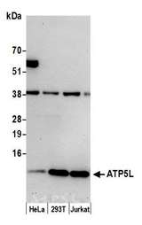 ATPase Subunit G / ATP5L Antibody - Detection of human ATP5L by western blot. Samples: Whole cell lysate (15 µg) from HeLa, HEK293T, and Jurkat cells prepared using NETN lysis buffer. Antibody: Affinity purified rabbit anti-ATP5L antibody used for WB at 0.1 µg/ml. Detection: Chemiluminescence with an exposure time of 30 seconds.