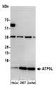 ATPase Subunit G / ATP5L Antibody - Detection of human ATP5L by western blot. Samples: Whole cell lysate (15 µg) from HeLa, HEK293T, and Jurkat cells prepared using NETN lysis buffer. Antibody: Affinity purified rabbit anti-ATP5L antibody used for WB at 0.1 µg/ml. Detection: Chemiluminescence with an exposure time of 30 seconds.