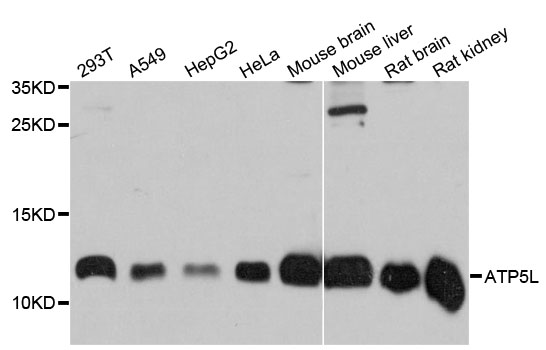 ATPase Subunit G / ATP5L Antibody - Western blot analysis of extracts of various cell lines.