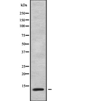 ATPase Subunit G / ATP5L Antibody - Western blot analysis of ATP5L using COLO205 whole cells lysates