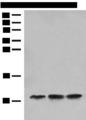 ATPase Subunit G / ATP5L Antibody - Western blot analysis of Human fetal liver tissue Hela cell HEPG2 cell lysates  using ATP5L Polyclonal Antibody at dilution of 1:500