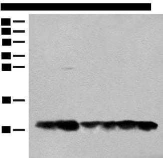 ATPase Subunit G / ATP5L Antibody - Western blot analysis of 293T cell Human fetal liver tissue lysates  using ATP5L Polyclonal Antibody at dilution of 1:500