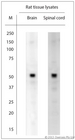 ATPASE6 / ATP6 Antibody - Rabbit antibody to MT-ATP6 (100-150). Blocking: 1% LFDM for 30 min at RT; primary antibody: dilution 1:2000 incubated at 4C overnight.