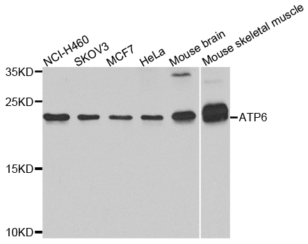 ATPASE6 / ATP6 Antibody - Western blot analysis of extracts of various cells.