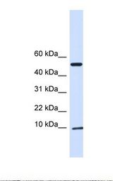 ATPIF1 / ATPI Antibody - 293T cell lysate. Antibody concentration: 1.0 ug/ml. Gel concentration: 10-20%.  This image was taken for the unconjugated form of this product. Other forms have not been tested.
