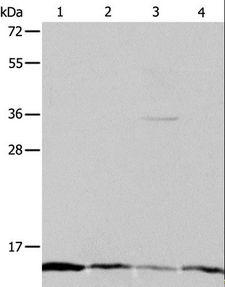ATPIF1 / ATPI Antibody - Western blot analysis of HeLa, Jurkat, MCF7 and A431 cell, using ATPIF1 Polyclonal Antibody at dilution of 1:1200.