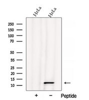 ATPIF1 / ATPI Antibody - Western blot analysis of extracts of COS-7 cells using ATPIF1 antibody. The lane on the left was treated with blocking peptide.