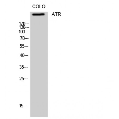 ATR Antibody - Western blot of ATR antibody