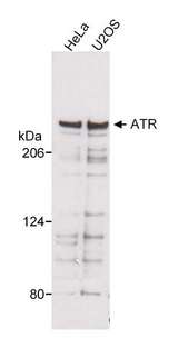 ATR Antibody - Detection of Human ATR by Western Blot. Samples: Whole cell lysate (20 ug) from HeLa and U2OS cells separated on a 3 to 8% Tris-acetate gel. Antibody: Affinity purified rabbit anti-ATR used at 0.07 ug/ml. Detection: Chemiluminescence with 15 second exposure.