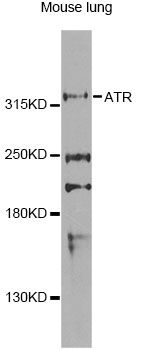 ATR Antibody - Western blot analysis of extracts of mouse lung, using ATR Antibody at 1:1000 dilution. The secondary antibody used was an HRP Goat Anti-Rabbit IgG (H+L) at 1:10000 dilution. Lysates were loaded 25ug per lane and 3% nonfat dry milk in TBST was used for blocking. An ECL Kit was used for detection and the exposure time was 90s.