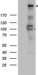 ATR Antibody - HEK293T cells were transfected with the pCMV6-ENTRY control. (Left lane) or pCMV6-ENTRY ATR. (Right lane) cDNA for 48 hrs and lysed. Equivalent amounts of cell lysates. (5 ug per lane) were separated by SDS-PAGE and immunoblotted with anti-ATR rabbit polyclonal antibody.