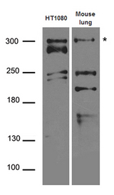 ATR Antibody - Western blot analysis of extracts. (35ug) from different cell lines and tissues by using anti-ATR rabbit polyclonal antibody.