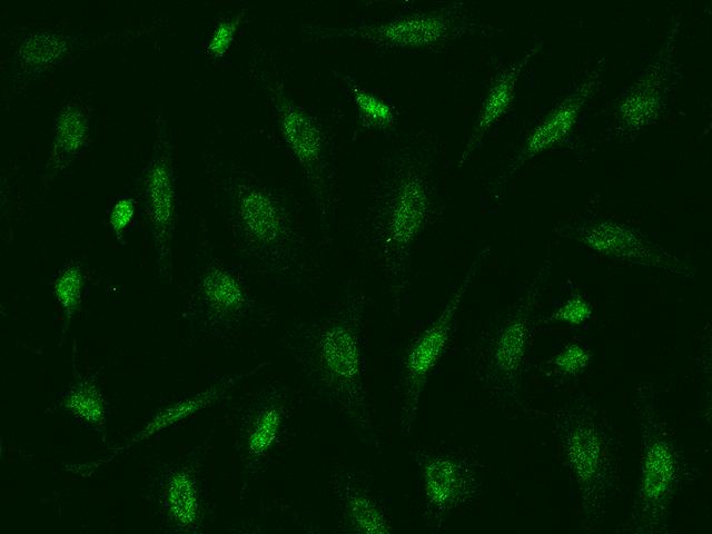 ATR Antibody - Immunofluorescence staining of ATR in Hela cells. Cells were fixed with 4% PFA, permeabilzed with 0.1% Triton X-100 in PBS, blocked with 10% serum, and incubated with rabbit anti-Human ATR polyclonal antibody (dilution ratio 1:500) at 4°C overnight. Then cells were stained with the Alexa Fluor 488-conjugated Goat Anti-rabbit IgG secondary antibody (green). Positive staining was localized to Nucleus.