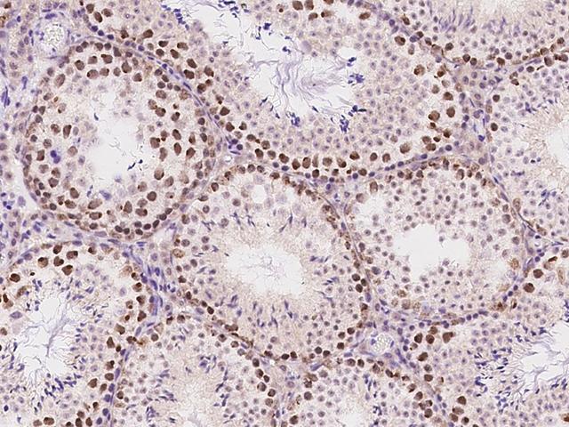 ATR Antibody - Immunochemical staining ATR in mouse testis with rabbit polyclonal antibody at 1:200 dilution, formalin-fixed paraffin embedded sections.