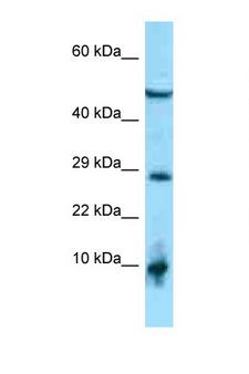 ATRAID / C2orf28 Antibody - C2orf28 antibody Western blot of 1 Cell lysate. Antibody concentration 1 ug/ml.  This image was taken for the unconjugated form of this product. Other forms have not been tested.