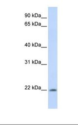 ATRAID / C2orf28 Antibody - Fetal muscle lysate. Antibody concentration: 1.0 ug/ml. Gel concentration: 12%.  This image was taken for the unconjugated form of this product. Other forms have not been tested.