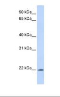 ATRAID / C2orf28 Antibody - Fetal muscle lysate. Antibody concentration: 1.0 ug/ml. Gel concentration: 12%.  This image was taken for the unconjugated form of this product. Other forms have not been tested.