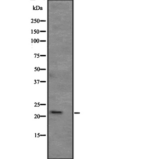 ATRAID / C2orf28 Antibody - Western blot analysis of APR3 expression in human kidney tissue lysate. The lane on the left is treated with the antigen-specific peptide.
