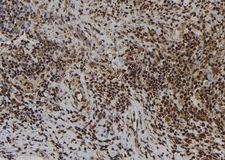 ATRAID / C2orf28 Antibody - 1:100 staining human spleen tissue by IHC-P. The sample was formaldehyde fixed and a heat mediated antigen retrieval step in citrate buffer was performed. The sample was then blocked and incubated with the antibody for 1.5 hours at 22°C. An HRP conjugated goat anti-rabbit antibody was used as the secondary.