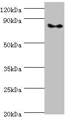 ATRIP Antibody - Western blot All lanes: ATRIP antibody at 2µg/ml + PC-3 whole cell lysate Secondary Goat polyclonal to rabbit IgG at 1/10000 dilution Predicted band size: 86, 84, 77, 73 kDa Observed band size: 86 kDa