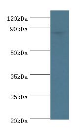 ATRIP Antibody - Western blot. All lanes: ATRIP antibody at 8 ug/ml+PC-3 whole cell lysate. Secondary antibody: Goat polyclonal to rabbit at 1:10000 dilution. Predicted band size: 86 kDa. Observed band size: 86 kDa.