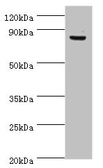 ATRIP Antibody - Western blot All lanes: ATRIP antibody at 8µg/ml + PC-3 whole cell lysate Secondary Goat polyclonal to rabbit IgG at 1/10000 dilution Predicted band size: 86, 84, 77, 73 kDa Observed band size: 86 kDa