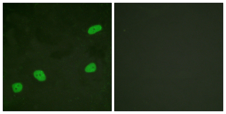 ATRIP Antibody - Immunofluorescence analysis of HeLa cells, using ATRIP Antibody. The picture on the right is blocked with the synthesized peptide.