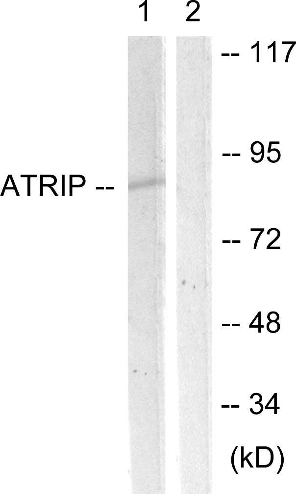 ATRIP Antibody - Western blot analysis of lysates from NIH/3T3 cells, using ATRIP Antibody. The lane on the right is blocked with the synthesized peptide.