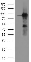 ATRIP Antibody - HEK293T cells were transfected with the pCMV6-ENTRY control (Left lane) or pCMV6-ENTRY ATRIP (Right lane) cDNA for 48 hrs and lysed. Equivalent amounts of cell lysates (5 ug per lane) were separated by SDS-PAGE and immunoblotted with anti-ATRIP.