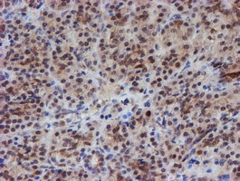 ATRIP Antibody - IHC of paraffin-embedded Human pancreas tissue using anti-ATRIP mouse monoclonal antibody.