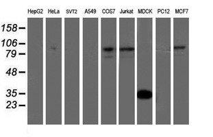 ATRIP Antibody - Western blot of extracts (35ug) from 9 different cell lines by using anti-ATRIP monoclonal antibody.