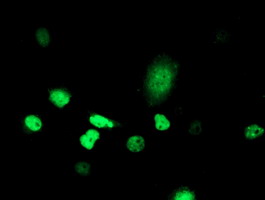 ATRIP Antibody - Anti-ATRIP mouse monoclonal antibody immunofluorescent staining of COS7 cells transiently transfected by pCMV6-ENTRY ATRIP.