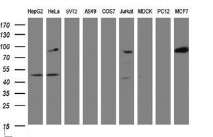 ATRIP Antibody - Western blot of extracts (35 ug) from 9 different cell lines by using g anti-ATRIP monoclonal antibody (HepG2: human; HeLa: human; SVT2: mouse; A549: human; COS7: monkey; Jurkat: human; MDCK: canine; PC12: rat; MCF7: human).