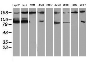 ATRIP Antibody - Western blot of extracts (35 ug) from 9 different cell lines by using g anti-ATRIP monoclonal antibody (HepG2: human; HeLa: human; SVT2: mouse; A549: human; COS7: monkey; Jurkat: human; MDCK: canine; PC12: rat; MCF7: human).