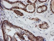 ATRIP Antibody - IHC of paraffin-embedded Human breast tissue using anti-ATRIP mouse monoclonal antibody.
