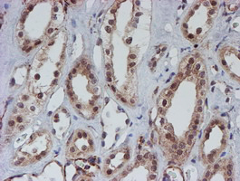 ATRIP Antibody - IHC of paraffin-embedded Human Kidney tissue using anti-ATRIP mouse monoclonal antibody.