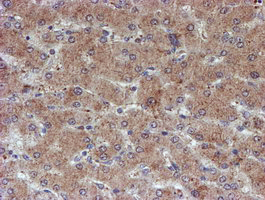 ATRIP Antibody - IHC of paraffin-embedded Human liver tissue using anti-ATRIP mouse monoclonal antibody.