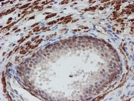 ATRIP Antibody - IHC of paraffin-embedded Human prostate tissue using anti-ATRIP mouse monoclonal antibody.
