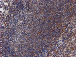 ATRIP Antibody - IHC of paraffin-embedded Human tonsil using anti-ATRIP mouse monoclonal antibody.