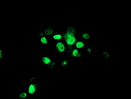 ATRIP Antibody - Anti-ATRIP mouse monoclonal antibody immunofluorescent staining of COS7 cells transiently transfected by pCMV6-ENTRY ATRIP.