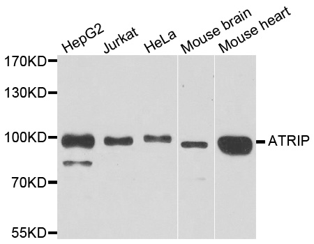 ATRIP Antibody - Western blot analysis of extracts of various cell lines.
