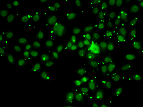 ATRIP Antibody - Immunofluorescence analysis of A549 cells.